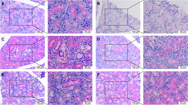 H&E staining of submandibular glands of mice in the blank (A), model (B), HCQ (C), FRZ-H (D), FRZ-M (E) and FRZ-L (F) treatment groups. Red arrows indicate the tissue infiltration and abnormal ordering of the acini and ducts. Scale bar = 100 μm (magnification, ×200) in the left panel and 50 μm (magnification, ×400) in the right panel. The cytoplasm of submandibular gland tissue cells is stained red, and nuclei are stained blue