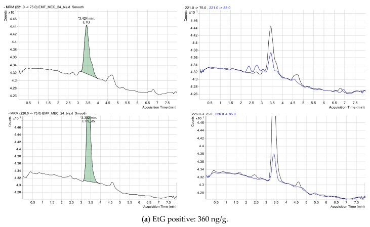 Chromatogram in two meconium samples testing positive for EtG. The retention time of substance ranged from 3 to 3.5 min depending on the column life span. The black line depicts the quantitative transitions and the blue line depicts the qualitative transitions. The green shade represents the quantification of EtG using the calibration curves. The “multiple reaction monitoring” (MRM) program takes into account the following transitions: EtG quantifier 221 > 75 and qualifier 221 > 85, internal standard (EtG-d5) quantifier 226 > 75 and qualifier 226 > 85. (a) sample EMF_MEC_24 with a positive concentration of 360 ng/g; (b) sample EMF_MEC_47 with a positive concentration of 420 ng/g.