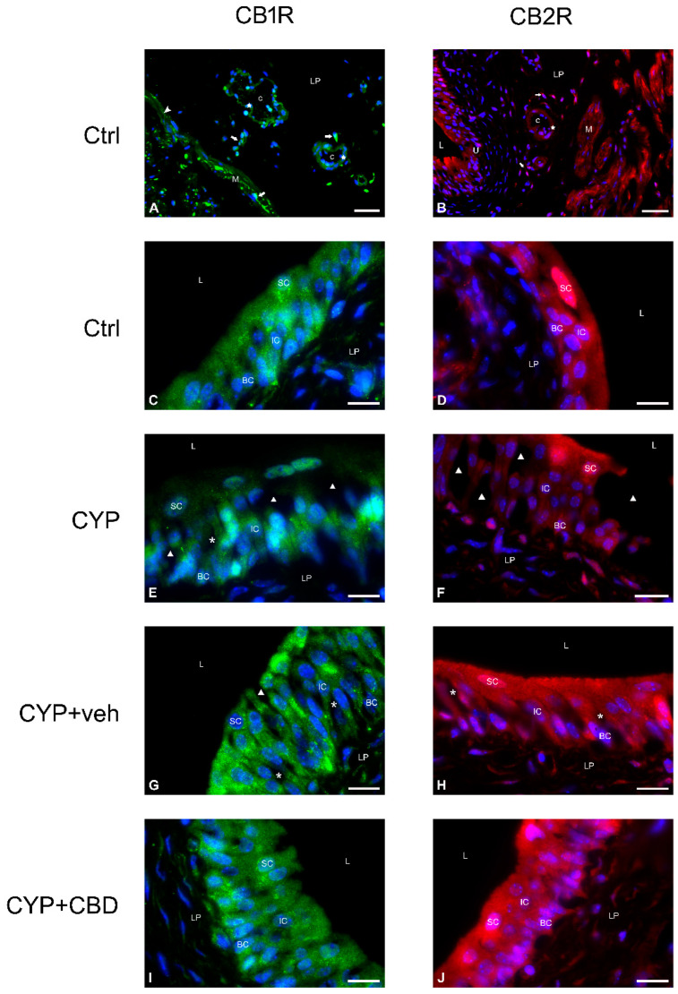 Representative micrographs of immunofluorescence labelling of CB1 and CB2 cannabinoid receptors in the bladder wall (A,B) and in the urothelium (C–J) of all experimental groups of mice. (A,C,E,G,I) Positive immunofluorescence reaction for CB1R is shown in green, and nuclei are shown in blue due to DAPI staining. (B,D,F,H,J) Positive immunofluorescence reaction for CB2R is shown in red, and nuclei are shown in blue due to DAPI staining. L—lumen of the bladder, U—urothelium, SC—superficial cell, IC—intermediate cell, BC—basal cell, LP—lamina propria, M—muscle cell, arrow—interstitial cell, triangle—urothelial injury, asterisk—dilated intercellular space, star—endothelial cell, arrowhead—nerve ending, c—capillary. Scale bars: (A,B) 50 µm; (C–J) 20 µm.