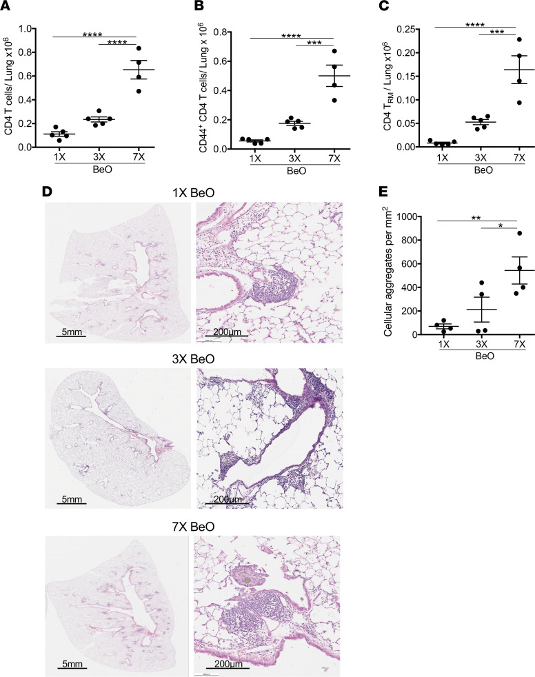 Beryllium exposure induces a dose-dependent increase in CD4+ T cell accumulation and mononuclear infiltrates in the lungs.HLA-DP2 Tg mice were exposed to 1 (1×), 3 (3×), or 7 (7×) doses of BeO (100 μg), and lungs were harvested on day 21. (A–C) Number of total CD4+ T cells (A), CD44+ Teffs (B), and CD103+CD69+ resident memory CD4+ T cells (C) in the lungs at day 21 were analyzed. (D) Representative H&E-stained lung sections of HLA-DP2 Tg mice treated with 1× (top), 3× (middle), and 7× (bottom) doses of BeO are shown at low and high magnification. (E) Quantification of cellular aggregates in the lungs of HLA-DP2 Tg mice exposed to 1 (1×), 3 (3×), or 7 (7×) doses of BeO. Data (mean ± SEM) are representative of 3 independent experiments (3–5 mice per group). One-way ANOVA was used to test for differences. *P < 0.05, **P < 0.01, ***P < 0.001, ****P < 0.0001.