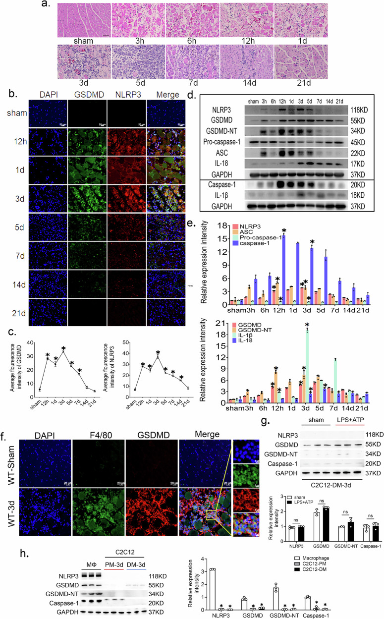 Macrophages as the main cell type undergoing pyroptosis after skeletal muscle injury.a Representative images of histomorphology of the process of skeletal muscle injury repair, scale bar = 50 μm. b Representative immunofluorescence images of NLRP3 and GSDMD, scale bar = 20 μm. c Average fluorescence intensity of NLRP3 and GSDMD, n = 3. d, e Western blot and quantitative analysis of NLRP3 inflammasome, caspase-1, GSDMD, GSDMD-NT, IL-1β and IL-18 proteins from whole muscle tissue lysates, n = 3. f Representative immuno- fluorescence pictures of F4/80(green) and GSDMD(red) colocalization in the injury area 3 days after skeletal muscle injury, large image scale bar = 20 μm, small image scale bar = 5 μm. Data are represented as mean ± SD, *p < 0.05 versus sham group. g Western blot analysis of pyroptosis markers (NLRP3, cleaved caspase-1, and GSDMD-NT) in differentiated C2C12 myotubes treated with or without LPS + ATP. n = 3; ns not significant. h Representative Western blots and quantification of pyroptosis markers in primary peritoneal macrophages, C2C12, and differentiated C2C12 myotubes under identical LPS + ATP stimulation. n = 3, data are represented as mean ± SD; *p < 0.05 versus macrophage group.