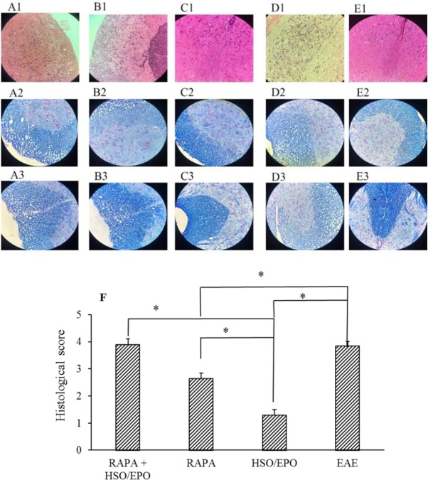 Pathological analysis of the spinal cord sections. Group A, RAPA + HSO/EPO-treated mice showed (A1) infiltration of inflammatory cells, (A2,3) vacuolation, spongy lesions, and extensive demyelination; Group B, rapamycin-treated mice showed (B1) numerous inflammatory cells, (B2,3) spongiotic zones and demyelination; extensive demyelination; Group C, HSO/EPO-treated mice showed (C1), a few inflammatory cells and (C2,3) without spongy lesions and demyelination; Group D, EAE control mice showed (D1) severe infiltration of numerous immune cells and, (D2,3) extensive vacuolation, zones of spongy degeneration, and demyelination; Group E, in the section of E1-3 from naive mice exhibiting no clinical signs. The first row was stained with H&E, the second and third rows were stained with LFB; F, histological score: 0 = no pathologic presentation, 1 = no tissue damage but minor inflammation, 2 = modest inflammation, prime tissue damage and demyelination, 3 = moderate tissue damage (demyelination, neuronal loss, tissue damage, cell death, neuronal vacuolation, and neuronophagia), 4 = necrosis (loss of all tissue elements entirely with associated cellular remains). Data are presented as mean ± SEM. *Indicates significant differences between corresponding groups (P ≤ 0.05). EAE, experimental autoimmune encephalomyelitis; HSO/EPO, hemp seed oil/evening primrose oil; RAPA, rapamycin; H&E, hematoxylin and eosin; LFB, luxol fast blue.