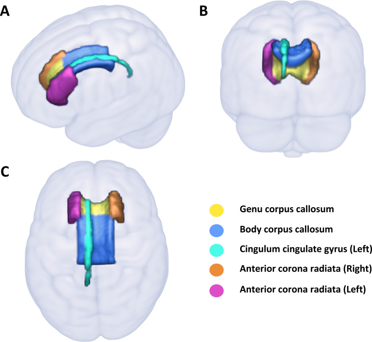 White matter regions significantly associated with cannabis use. Structures delineated by the JHU White Matter Atlas (ICBM-DTI-81) are presented in (A) sagittal, (B) coronal and C) axial views.