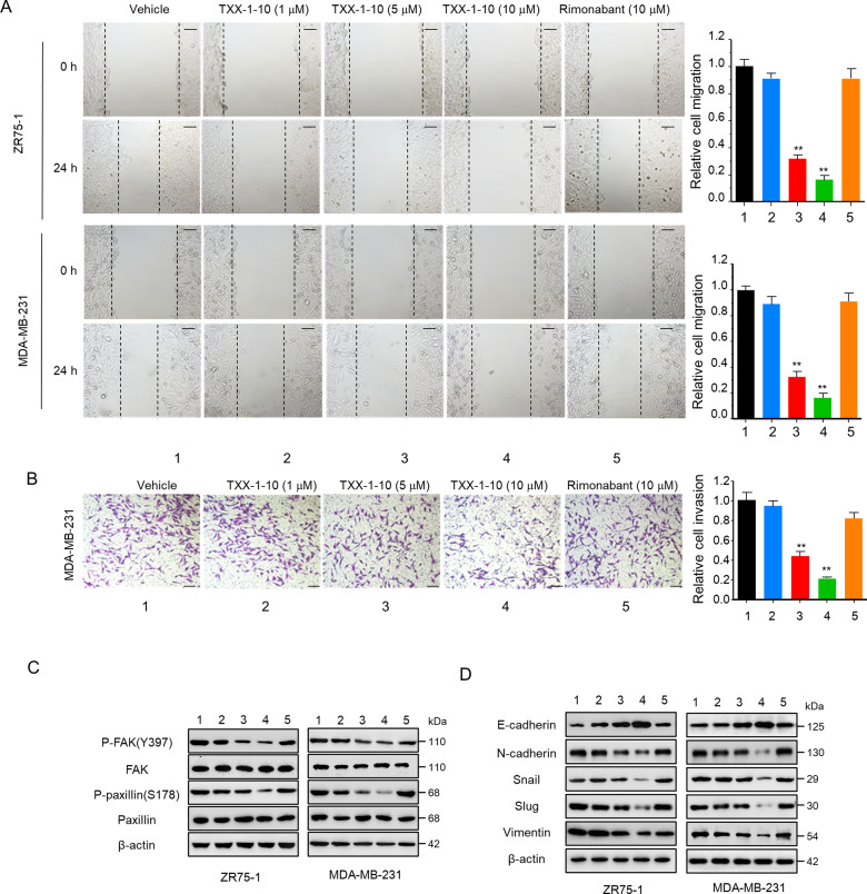 TXX-1-10 inhibits breast cancer cell migration and invasion.A Wound-healing assay of ZR75-1 and MDA-MB-231 cells treated with TXX-1-10, rimonabant or vehicle control (DMSO) following mitomycin C (1 μM) treatment at the indicated time. Histograms show the relative cell migration (right panel). Scale bar: 100 μm. B Transwell assay of MDA-MB-231 cells treated as in A. Invasive cells were fixed and stained with crystal violet. Histograms show the relative cell invasion (bottom). C Western blot assay of ZR75-1 and MDA-MB-231 cells treated with increasing concentrations of TXX-1-10 for 24 h with the indicated antibodies. D Western blot assay of ZR75-1 and MDA-MB-231 cells treated with increasing concentrations of TXX-1-10 for 24 h with the indicated antibodies. Data shown are mean ± SD of triplicate measurements that have been repeated three times with similar results. Statistical significance was assessed by two-tailed Student’s t test. *p < 0.05, **p < 0.01 versus the corresponding control.