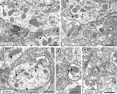 Electron micrographs showing D2R immunogold particles within the cytoplasm (small black arrows) and on the plasma membrane (white block arrows) of somatodendritic profiles without detectable CB1R immunoperoxidase labeling in the Acb shell (a) and dorsal striatum (G-D). In a and b, the somata are contacted by axonal profiles that are either unlabeled terminals (Ut-1–2), CB1R immunoperoxidase-labeled terminals (CB1-t) or D2R containing axons (D2-ax) or terminals (D2-te). In c, immunogold particles identifying the D2R are seen in a transversely sectioned medium-diameter dendrite (D2-de). This dendrite receives an inhibitory-type synapse from an axon terminal (CB1R-t) showing faint CB1R-immunoperoxidase labeling. In d, the cytoplasmic D2R-immunogold particles are localized to endomembranes (asterisk) in the transition zone between the plasma membrane at an excitatory-type synapse and the outer membrane of a mitochondrion (m). Unlabeled terminals (Ut-1 and Ut-2) are presynaptic to the D2R-labeled dendrite. In e, cytoplasmic immunogold labeling (arrows) for the D2R is seen in a small dendrite that also contains CB1R-immunoperoxidase reaction product (D2-CB1-de) associated with an endomembrane (asterisk) and the postsynaptic membrane specialization beneath a D2R-labeled axon terminal. Within this terminal, one immunogold particle is in the cytoplasm (small black arrow) and the second is in contact with the plasmalemma (block arrow). In bar graphs, values are expressed as means and standard errors; n = 6 animals/treatment group; *p < 0.05. In micrographs, scale bars = 500 nm
