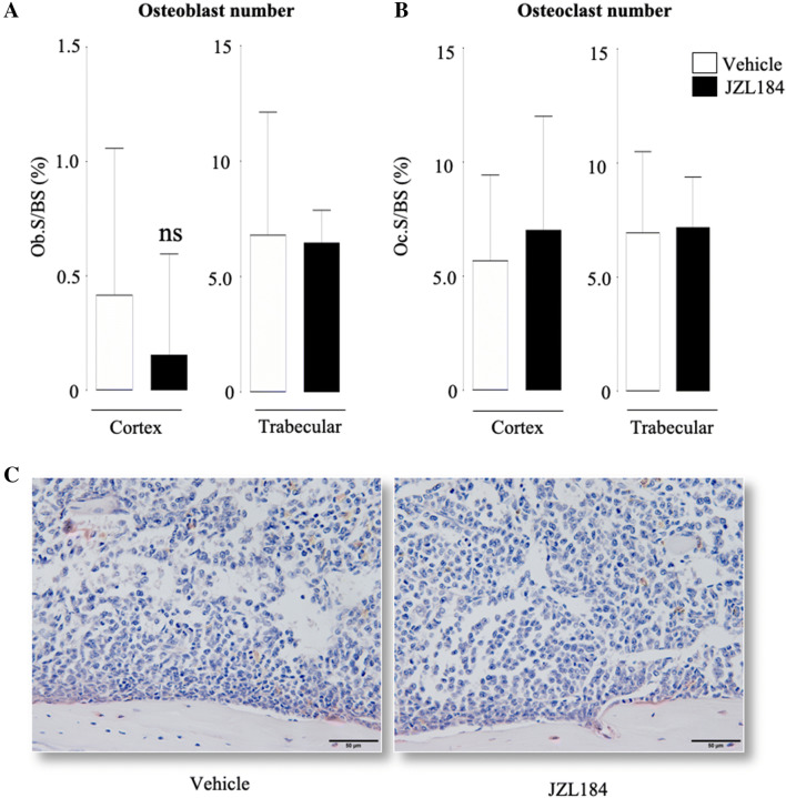 Effects of JZL184 on osteoblast and osteoclast number in mice bearing MM. In vivo percentage of osteoblasts (a, Ob.S/BS, %) and osteoclasts (b, Oc.S/BS, %) from the cortical and trabecular compartments of the tibial metaphysis of 8-week-old adult C57BL/6KalWRij mice treated with vehicle (0.01% DMSO) (n = 8) or JZL184 (16 mg/kg, thrice-weekly) (n = 8) for 21 days post injection of mouse 5TGM1-GFP MM cells (106 cells/mouse). c Representative photomicrographs of histological sections from the experiment described. Scale bar = 50 µm. Values are mean ± SD; ns denotes not statistically significant