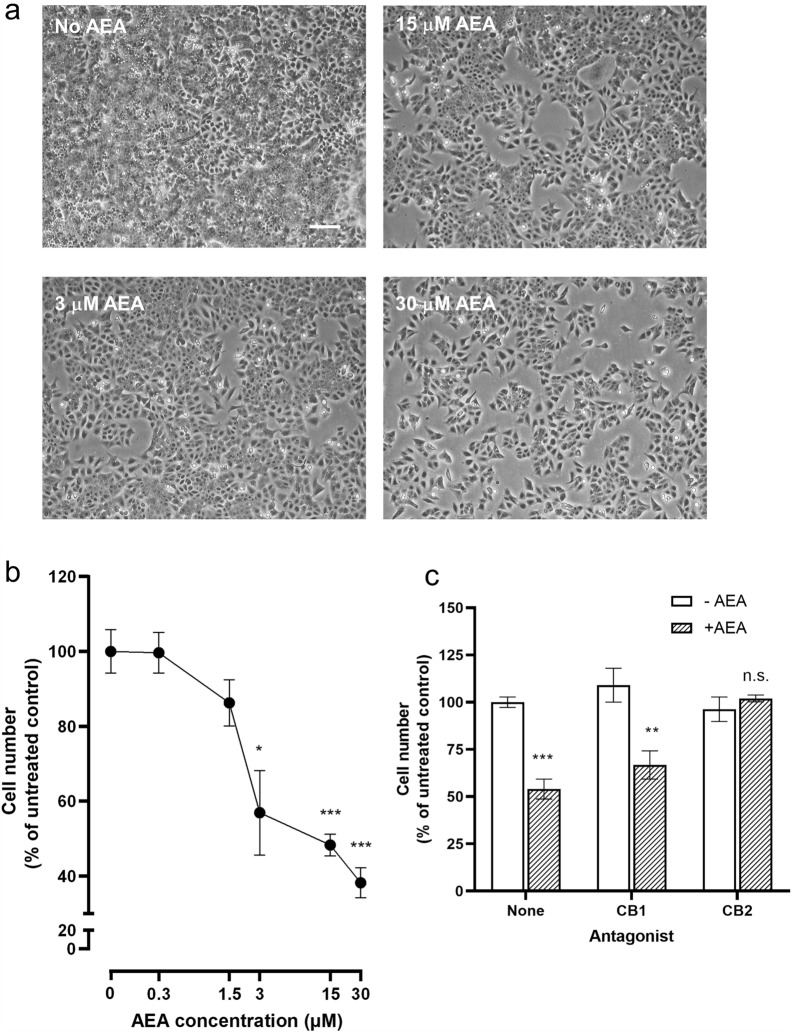 Effect of AEA on TCL-1 cell growth and survival. Representative photomicrographs of third-trimester trophoblasts (TCL-1 cells) grown in the indicated concentrations of AEA for 48 h are shown in panel a. Note the dose-dependent reduction in cell density. Each experiment was performed four times in triplicate. Bar, 120 µm. Panel b shows the results of the XTT proliferation and apoptosis assay. The data are presented as the mean ± SEM of four experiments performed in quadruplicate and relative to the untreated (control) cultures. *p < 0.05; **p < 0.01; ***p < 0.0001; one-way ANOVA with Dunnett’s T3 multiple comparisons tests. Panel c shows a similar XTT cell density experiment for TCL-1 cells treated with AEA (3 μM) in the presence of the CB1 antagonist SR141716a (CB1) or SR144528 (CB2). Data are presented as the mean ± SEM of three experiments performed in quadruplicate and relative to the untreated (control) cultures (−AEA; none). **p < 0.01; ***p < 0.0001; n.s. non-significant; one-way ANOVA with Dunnett’s T3 multiple comparisons tests