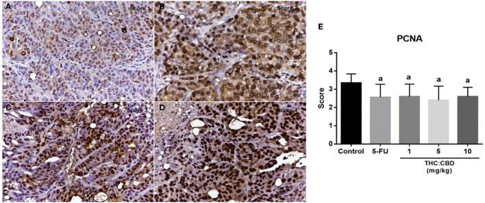 The expression score of PCNA in tumor (A) score = 1, (B) score = 2, (C) score = 3, and (D) score = 4 (counterstained with Mayer's hematoxylin, 40×). The graph demonstrates the expression score of PCNA in the negative control group, the positive control group (5-FU), and THC:CBD at the dose of 1, 5, and 10 mg/kg BW. Data were expressed as mean ± SD. a indicates a significant difference at P < 0.05 compared to the negative control group (E).