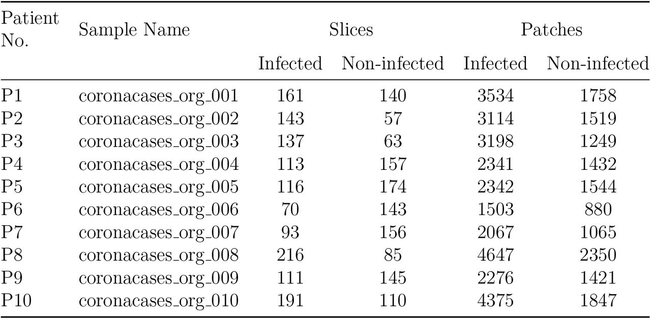 Distribution of infected and non-infected Slices & Patches extracted for training