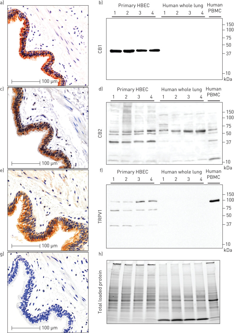 In situ and in vitro validation of CB1, CB2 and TRPV1 protein expression in human airway epithelial cells. Serial sections from a single patient donor that is representative of n=10, for immunohistochemistry of a) CB1, c) CB2 and e) TRPV1 with g) negative control. Immunoblots on primary human airway epithelial cells cultured in vitro: b) CB1, d) CB2, and f) TRPV1 with h) total protein loading control (n=4 airway epithelial cells (HBEC), n=4 whole-lung samples, n=1 peripheral blood mononuclear cells (PBMCs)). Molecular weights (in kilodaltons) are denoted on y-axis of immunoblots.