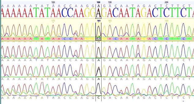 Analysis of rs1243008337 SNP of CNR1 gene