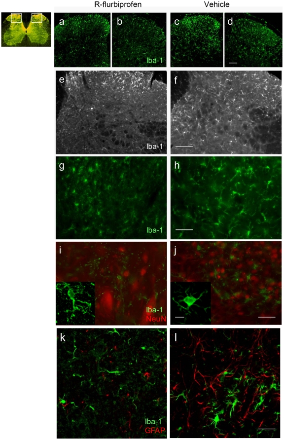 Immunofluorescence analysis of microglia in the spinal cord dorsal horn seven days after nerve injury.Microglia was identified by Iba-1 immunoreactivity (green). Mice were treated with R-flurbiprofen (4.5 mg/kg twice daily, left panel) or vehicle (right panel). Figures show the side ipsi lateral to the nerve lesion (a, c, e, f, g, h, i, j, k, l) and the contra lateral side (b, d). The inserts in i and j are z-projections. In I, J neurons were visualized by NeuN immunofluorescence (red). In k, l astrocytes were stained for glial fibrillary acidic protein (GFAP, red). Scale bars: 100 µm in a–f; 50 µm in g–l; 20 µm in the inserts of I, j.