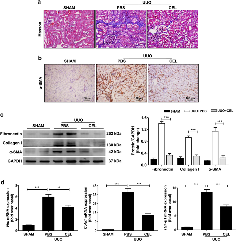 Celastrol suppresses renal fibrosis in UUO mouse model.The mice received celastrol (1 mg/kg) daily for 7 days from the day of surgery. The vehicle-treated mice were treated with an equal volume of PBS, and the sham group was used as the control for UUO. Kidney tissues were collected 7 days after UUO. a Masson’s trichrome staining of kidney tissues sections. Scale bar = 50 μm. b Representative micrographs and quantitative assessment of the expression and distribution of α-SMA in kidney tissues using immunohistochemical staining. Scale bar = 100 μm. c Western blot analyses of renal fibronectin, collagen I, and α-SMA protein in kidney tissues. Representative western blot and quantitative data were presented. d Expression of the pro-fibrotic mediators Vim, Cola1, and TGF-β1 was measured using qRT-PCR. All values are represented as mean ± SEM. n = 5/group. **P < 0.01 and ***P < 0.001