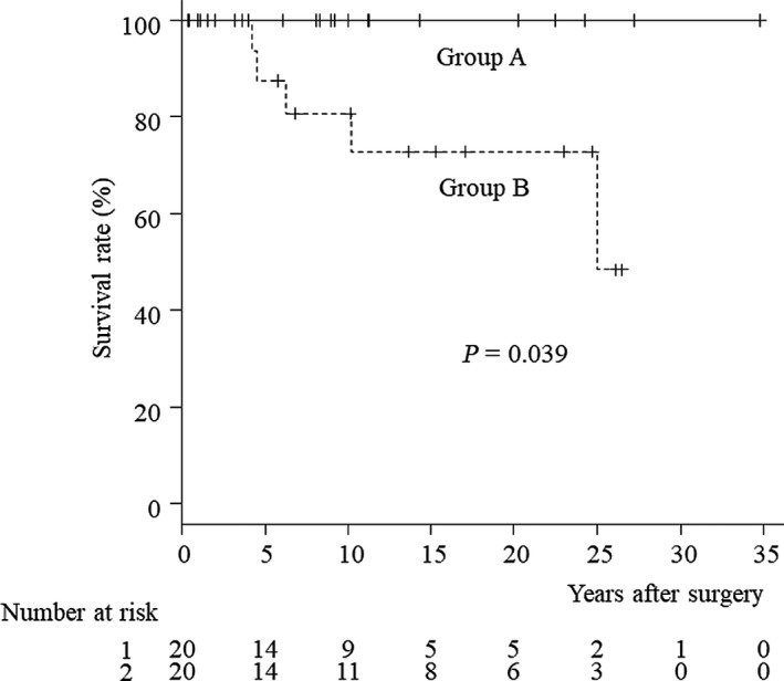 Survival rates after the biliary diversion operation according to the types of congenital biliary dilatation. Group A comprised 20 patients classified as type Ia, Ic, or no dilation of the bile ducts, while group B comprised 20 patients classified as type IV‐A