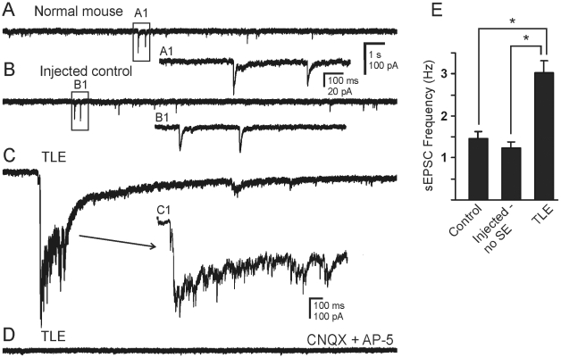 Increase in synaptic activity in granule cells from pilocarpine-treated mice that survived SE and developed TLE. A. sEPSCs recorded from granule cell of normal mouse. B. sEPSCs recorded from granule cell of a mouse that was injected with pilocarpine but did not develop SE. C. sEPSCs and bursting activity recorded from a granule cell of a pilocarpine-treated mouse that developed TLE. D. Trace showing that sEPSCs were blocked by application of ionotropic glutamate receptor antagonists, CNQX (10 µM) and AP-5 (50 µM). A1 and B1 are expanded boxed regions of A and B. C1, expansion of the sEPSC showing increased synaptic activity during the burst seen in C. Recordings were made in the absence of added Mg2+ and the presence of bicuculline (30 µM). E. Bar graph comparing the frequency of sEPSCs among the three groups of animals. Asterisk indicates significantly higher frequency in cells from mice with TLE (P<0.05).
