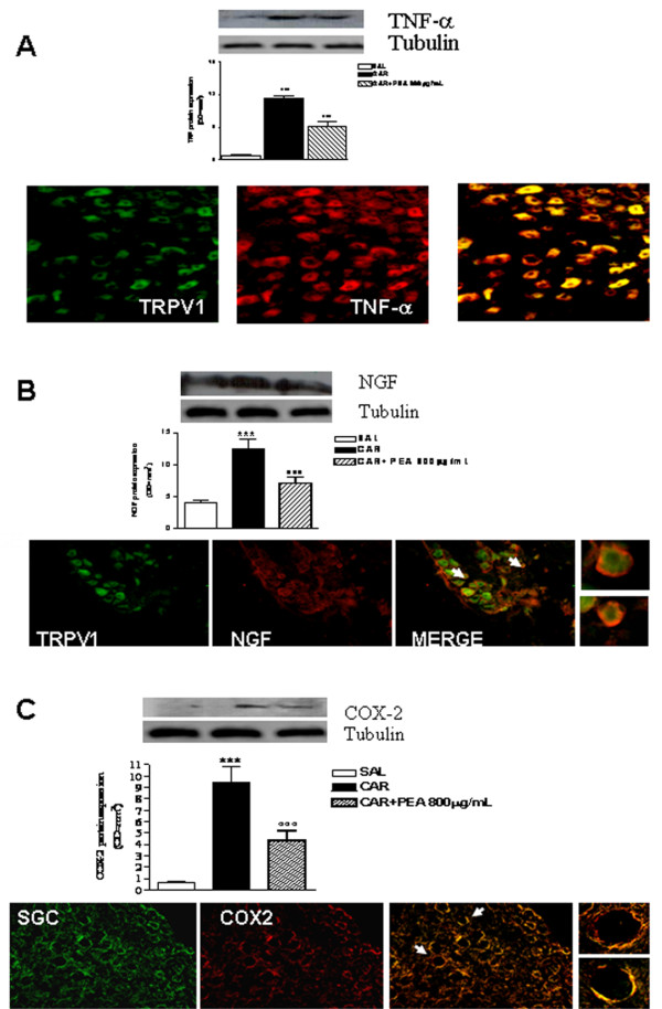 Effect of PEA on DRG biomolecular and morphological changes induced by granuloma. The effect of granulomatous inflammation on the biomolecular and morphological changes in the DRGs was associated with increased expression of TNF-α (A), NGF (B) and COX-2 (C). The levels of all proteins studied were significantly reduced by PEA treatment as revealed by Western blot analysis (A, B and C upper panels). Our results show that TNF-α and NGF were expressed by neurons as revealed by double labeling with TRPV1 receptor expressed in the DRG (A and B bottom panel) while COX-2 was highly expressed by satellite glial cells identified by glutamine synthetase staining (C bottom panel). Results are expressed as mean ± SEM of 3 experiments. ***p < 0.001 vs saline; °°°p < 0.001 vs λ-carrageenin alone.