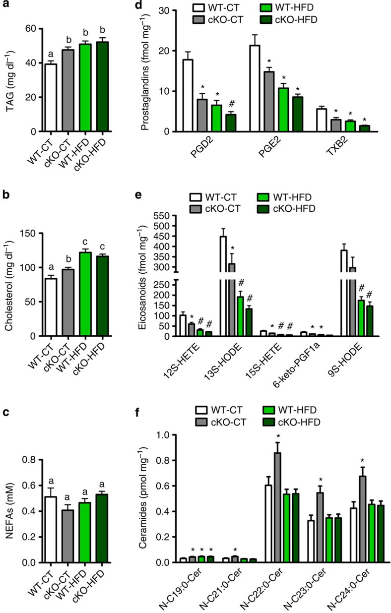 Adipose tissue Napepld deletion alters adipose and whole-body lipid metabolism.(a) Plasma triglyceride content (mg dl−1; n=20–27). (b) Plasma cholesterol content (mg dl−1; n=20–27). (c) Plasma non-esterified fatty acid (NEFA) levels (mM; n=20–27). These data (a–c) correspond to the results of three independent experiments. (d) SAT prostaglandin content measured by LC-MS/MS in fmol per mg tissue (n=10). (e) SAT eicosanoid content measured by LC-MS/MS in fmol per mg tissue (n=10). (f) SAT ceramide content measured by ESI-MS/MS in pmol per mg tissue (n=10). See also Supplementary Table 1. Data are presented as mean±s.e.m. Data with different superscript letters or symbols are significantly different (P<0.05) according to post-hoc one-way analysis of variance. ‘*’ indicates a significant difference (P<0.05) versus WT-CT, and ‘#’ indicates a significant difference (P<0.05) versus WT-CT and cKO-CT according to post-hoc one-way analysis of variance.