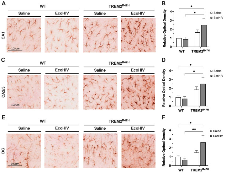 Hippocampal GFAP expression is increased in TREM2R47H mice infected with EcoHIV. (A) GFAP -immunostained vibratome sections in the CA1 sub-region of the hippocampus from wild type (WT) mice and TREM2R47H mice treated with saline or EcoHIV. (B) Relative optical density quantification of GFAP in CA1 sections. (C) GFAP-immunostained vibratome sections in the CA2/3 sub-region of the hippocampus of WT mice and TREM2R47H mice treated with saline or EcoHIV. (D) Relative optical density quantification of GFAP in CA2/3 sections. (E) GFAP-immunostained vibratome sections in the DG sub-region of the hippocampus of WT mice and TREM2R47H mice treated with saline or EcoHIV. (F) Relative optical density quantification of GFAP in DG sections. Scale bars represent 100 μm. Data presented as mean ± SEM normalized to WT-saline controls and analyzed using two-way ANOVA with Holm–Sidak’s multiple comparisons tests; n = 4–6 per condition; statistical significance was determined at * p < 0.05, ** p < 0.001. Abbreviations: GFAP, glial fibrillary acidic protein; CA, cornu ammonis; DG, dentate gyrus.