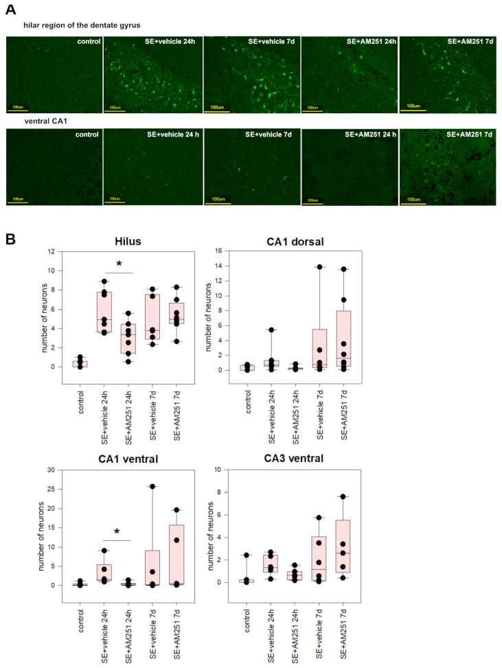 (A) Fluorojade C staining in the hilar region of the dentate gyrus (upper row) and CA1 of the ventral hippocampus (bottom row) in rats without SE (control), vehicle-treated treated rats (SE + vehicle), and AM251-treated rats (SE + AM251) 24 h and 7 days after SE; (B) the number of fluorescent neurons per field of view in rats with no SE (control), vehicle-treated treated rats (SE + vehicle), and AM251-treated rats (SE + AM251) 24 h and 7 days after SE. Data are presented as medians with interquartile ranges; dots represent individual values for each rat. *—significant differences at p < 0.05, Kruskal–Wallis test.