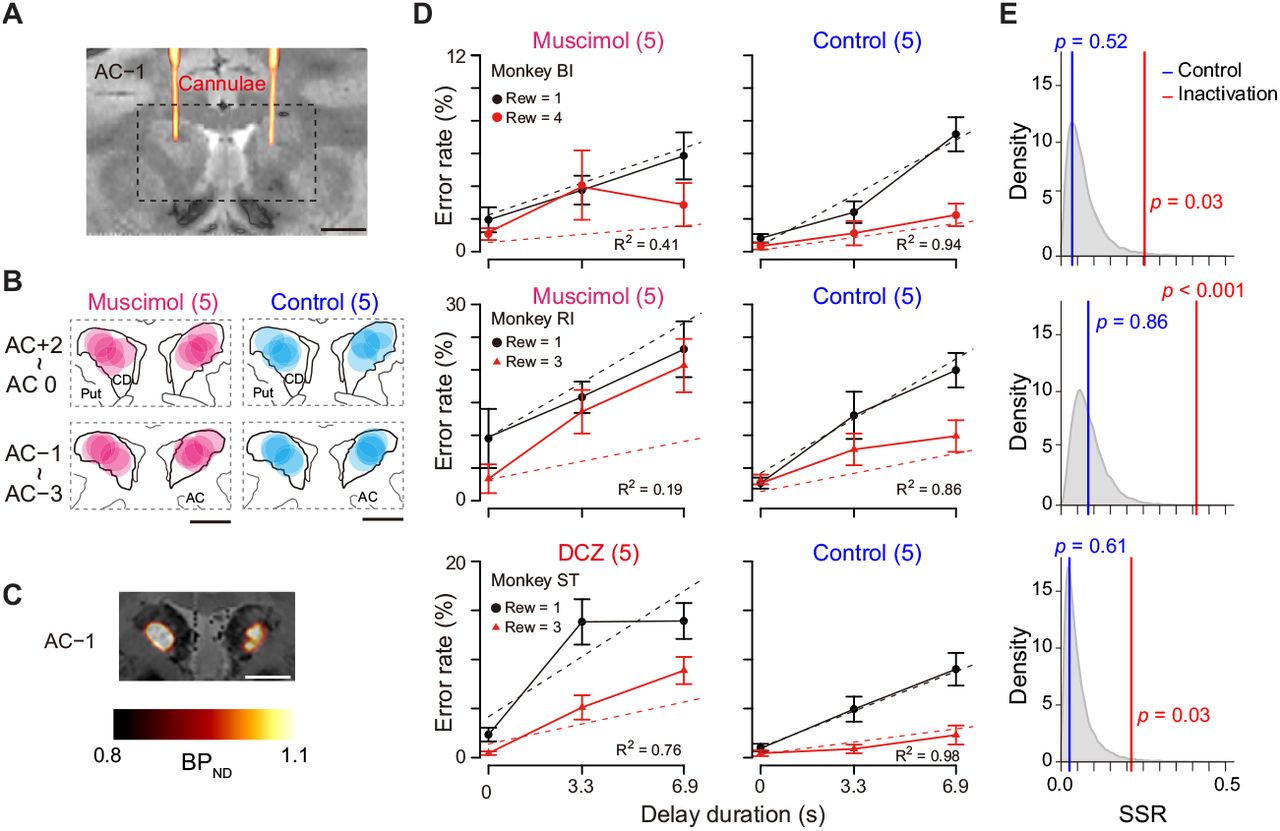 Bilateral inactivation of dCDh disrupted normal motivational performance based on size and delay.(A) CT-based localization of muscimol injection sites. CT image visualizing injection cannulae targeting CD bilaterally (hot color) overlaid on MR image (gray scale) in monkey BI. Scale bar, 5 mm. (B) Muscimol (magenta) and saline injection sites (blue) are mapped by estimating diffusion (4 mm in diameter) from the tip of the cannula. The data of two subjects are overlaid and are separately mapped 3 mm anterior and 3 mm posterior to the anterior commissure (AC). (C) [11C]DCZ-PET visualizing hM4Di expression in vivo in monkey ST. Parametric image of specific binding (BPND) of [11C]DCZ-PET overlaying MR image. Scale bar, 5 mm. (D) Error rates (mean ± sem) as function of delay duration under inactivation (left) and control condition (right). Black and red symbols are low and high reward trials, respectively. Dotted lines represent best-fit function of hyperbolic temporal discounting (Equation 2). Number in parentheses indicates number of sessions tested. (E) Distribution of sum of squared residuals (SSR) of best-fit function (Equation 2) to averaged resample data obtained by bootstrap method (n=20,000). Blue and red lines indicate SSR of best-fit of Equation 2 to mean error rates in control and inactivation sessions, respectively.