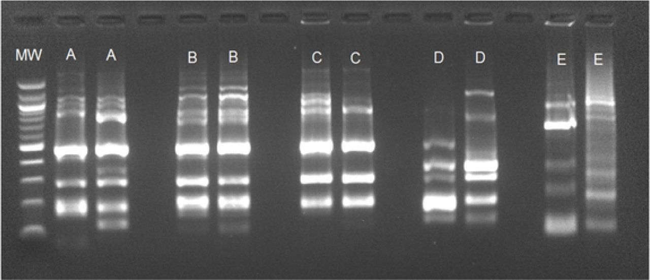 Genetic relatedness of study isolates. MW: Molecular Weight. Clone: A, B, C, D and E