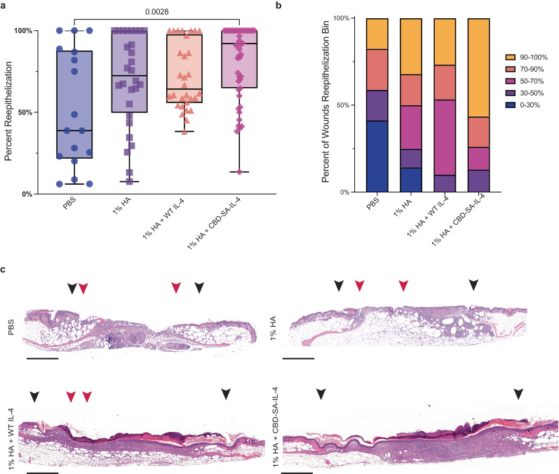 Topically applied 1% HA + CBD-SA-IL-4 enhances skin wound healing.Full-thickness back-skin wounds in 8-10-week-old C57BLKS/J-m/Lepr db (db/db) male mice treated with CBD-SA-IL-4 (100 µg/ mL) or WT IL-4 (100 µg/ mL). Four treatment groups were tested: PBS, 1% HA, 1% HA + WT IL-4, and 1% HA + CBD-SA-IL-4. After 11 days, a, b extent of reepithelization was evaluated by histology (PBS: n = 17, mean = 52.37% ± SEM); (1% HA n = 28, mean = 69.90 ± SEM); (1% HA + WT IL-4 n = 30, mean = 71.87 ± SEM); (1% HA + CBD-SA-IL-4 n = 47, mean = 81.29 ± SEM). b The wounds were binned based on percent closure after 11 days of healing (i.e. what percent of wounds were 90%–100% re-epithelized). c Representative wound histology (hematoxylin and eosin staining) at day 11 (scale bar 800 μm). Black arrowheads indicate margin of wound and red arrowheads indicted the tips of epithelium tongue. Statistics: a Analyzed using nonparametric, Kruskal–Wallis test with Dunn’s multiple comparison of mean rank of each group against the 1% HA + CBD-SA-IL-4 treated group. *p < 0.05, **p < 0.01, ***p < 0.001. Pooled from 3 experimental replicates. The non-parametric test was used due to the non-normality of the data set as confirmed by an Anderson–Darling test.