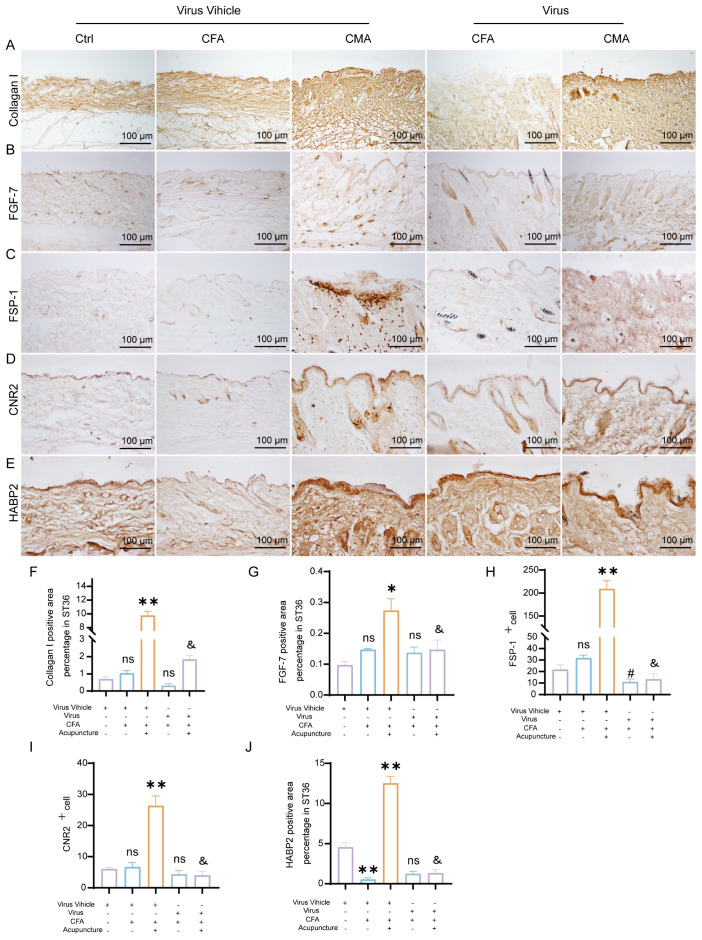 Microscopic images and bar charts depict the expression of specific proteins and cell markers across different treatment groups. Panels A to E show tissue stained for Collagen I, FGF-7, FSP-1, CNR2, and HABP2, respectively, with scale bars indicating 100 micrometers. Differences in expression are indicated. Panels F to J display corresponding bar charts quantifying positive area percentages, with statistical significance marked by asterisks and symbols denoting treatments involving Virus Vehicle, Virus, CFA, and Acupuncture.