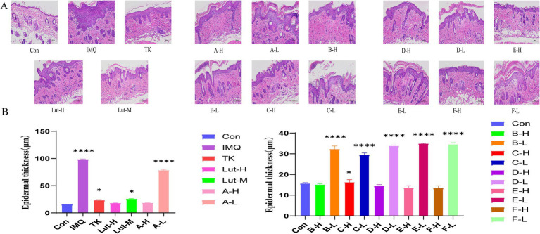 (A): H&E staining pattern of imiquimod induced back psoriasis in mice, (B): Skin epidermal thickness on the back of mice. (****) p < 0.0001 and (*) p < 0.05 versus control group.