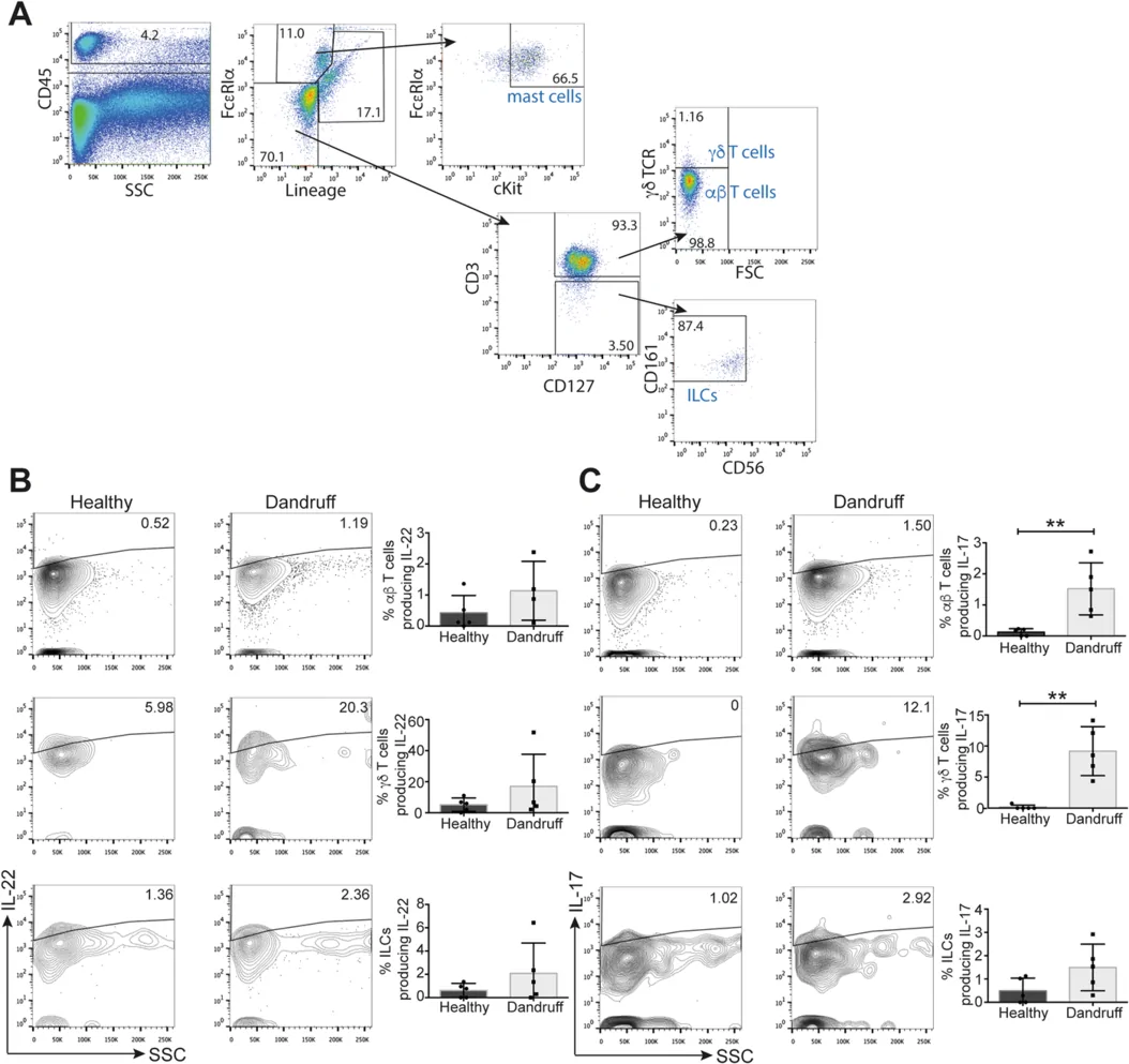 Dandruff scalp skin has increased numbers of IL‐17‐producing T cells. Cells were isolated from full‐thickness scalp skin punch biopsies by enzymatic digestion, and analysed by flow cytometry (representative flow cytometry plots to show the gating strategy for each cell population shown in panel A). Representative flow cytometry plots show IL‐22 production (B) and IL‐17 production (C) in each cell population. n = 5, **p < 0.01.