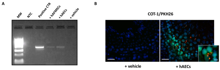 Human AECs and AFMCs retrieval in transplanted VAR rats. (A) Representative image of agarose gel electrophoresis of PCR products for human MT-CYB gene in testes explant extracts. MW: molecular weight marker (100 bp ladder); NTC: no template control; Positive CTR: human genomic DNA; +hAFMSCs-treated rat; +hAECs-treated rat; +vehicle-treated rat. (B) Representative FISH images showing hAECs PKH26 marked cells (red fluorescence) co-localizing with the human COT-1 probe (green fluorescence). Nuclei are counterstained with DAPI (blue color). Insert shows a magnification of signals colocalization. A representative image of VAR with vehicle (+vehicle) sample is shown as negative control of hybridization. Image Scale bar = 50 μm. Magnification scale bar = 10 μm.