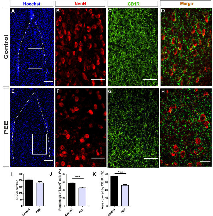 The population of mature neurons and the area covered by CB1R are smaller in the amygdala of PEE adults. Images of coronal sections of adult male mouse brains with Hoechst staining (blue) and immunofluorescence for NeuN (red) and CB1R (green) taken on an inverted microscope with SDU. Sections at the level of the amygdala of a Control (A) and PEE brain (E) at low magnification. Sections at the level of the amygdala of a Control (B,C) and PEE brain (F,G) at higher magnification. The merge of NeuN and CB1R immunofluorescence is shown at 60× magnification (D,H). Nuclei number (I), percentage of NeuN+ cells (%, J), area covered by CB1R (%, K). Data expressed as the mean ± SEM (Control n = 5 each one from five different control litters, PEE n = 5 each one from five different ethanol PEE litters); all parameters were analyzed by Student’s t-test (***p < 0.001). Scale bars: 100 μm (A,E), 50 μm (B,C,F,G), and 25 μm (D,H).