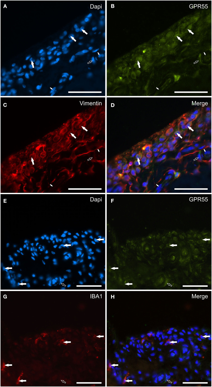 Photomicrographs of the cryosections of the synovial membrane of a horse metacarpophalangeal joint showing G protein-related receptor 55 (GPR55) immunoreactivity in synoviocytes and vascular cells. (A–D) The white arrows indicate the DAPI (Blue) labeled nuclei (A) of elongated cells resembling fibroblast-like synoviocytes co-expressing moderate GPR55 (Green) (B) and bright vimentin (Red) (C) immunoreactivity. The small white arrows indicate the DAPI labeled nuclei of the endothelial cells of the subintima blood vessels showing moderate GPR55 immunoreactivity which was also expressed by the vascular smooth muscle cells (open arrow). (E–H) The white arrows indicate the DAPI (Blue) labeled nuclei of macrophage-like synoviocytes co-expressing faint-to-moderate GPR55 (Green) (F) and bright IBA1 (Red) immunoreactivity (G). The open arrow indicates the nuclei of a vascular smooth muscle cell expressing moderate GPR55 immunoreactivity. (D, H) Merged images (orange). Scale bar = 50 μm.