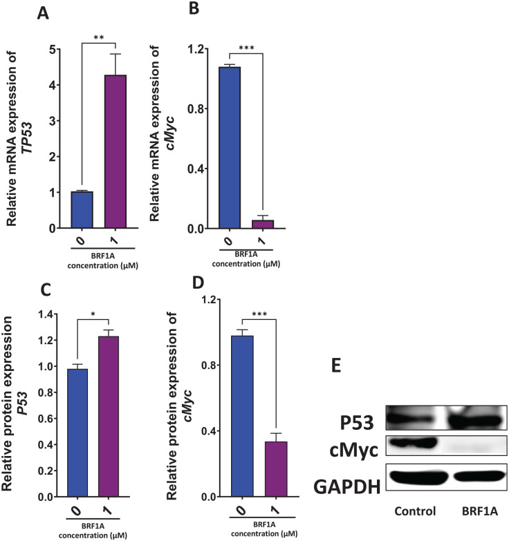 BRF1A enhanced the expression of TP53 and suppressed oncogene cMyc in IgE-producing myeloma cells. Myeloma cells were cultured with BRF1A at 1 µM for 48 hours, and mRNA was determined using qRT-PCR as described in the section “Materials and Methods.” mRNA expression after 48 hours. (A) TP53. (B) cMyc. Western blotting assay was conducted as described in the section “Materials and Methods.” (C) P53. (D) cMyc. (E) Western bands.Data represent triplicate experiments and are expressed as mean ± SD. *P < .05, **P < .01; ***P < .001 versus control (0.1% DMSO).