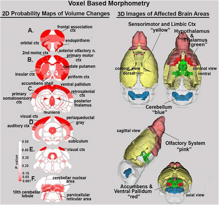 Voxel based morphometry. The location of many of the brain areas listed in Table 1 are shown in the 2D heat maps and are summarized in the 3D color-coded reconstructions to the right.