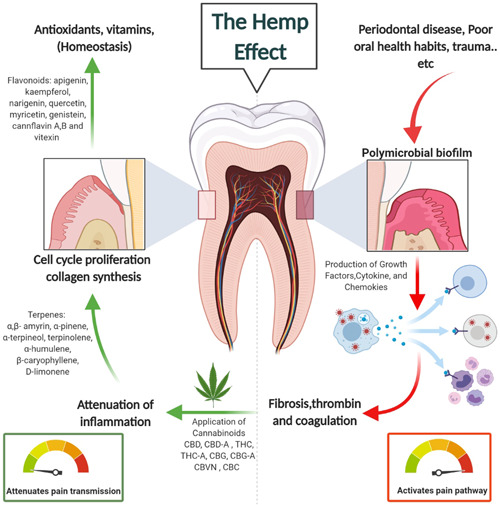 The immunomodulatory activity of phytocompounds found in hemp (cannabis) plant in dental‐associated inflammatory diseases including pulp pain. The diagram depicts the anti‐inflammatory activity of several natural compounds found in the hemp plant and the mode of impact to modulate and resolve pain and inflammation as an adjunct therapy. Several factors include poor oral hygiene and certain disease conditions (i.e., periodontitis) that initiate oral inflammation. After mechanical debridement of oral biofilms, the application of cannabis natural derivatives helps to attenuate the inflammatory process and controls inflammation. Created with BioRender.com