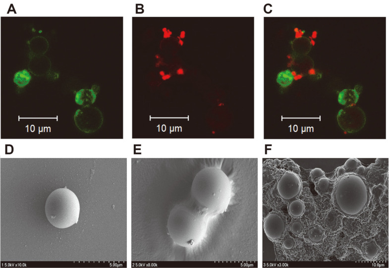 Images of Enterrococcus faecalis ATCC 29212 bound to recombinant protein-epoxy magnetic bead (eMB) complexes were obtained using confocal fluorescence microscopy and scanning electron microscopy (SEM).(A-C) Confocal fluorescence microscopy images of CBD–green fluorescent protein (GFP) fusion protein–eMB complex. (A) CBD–GFP–eMB complex bound to fluorescein isothiocyanate (FITC), green emission detected at 520 nm; (B) E. faecalis bound to CBD–GFP–eMB complex Cy 3, red emission detected at 675 nm; (C) overlap of (A) and (B). (D–F) SEM images of the CBD–eMB complex. (D) eMB; (E) CBD–eMB complex; (F) E. faecalis bound to CBD–eMB complex.