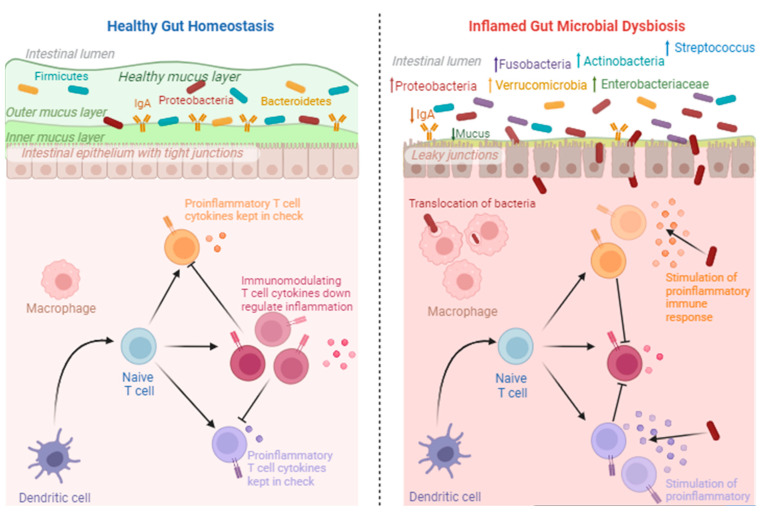 Healthy gut homeostasis vs. inflamed gut microbial dysbiosis. The downregulation of inflammatory cytokines occurs under healthy conditions. However, under inflammatory conditions, proinflammatory cytokines are upregulated as a result of increases in pathogenic microorganisms. This image was created using Biorender.com (accessed 27 September 2023).