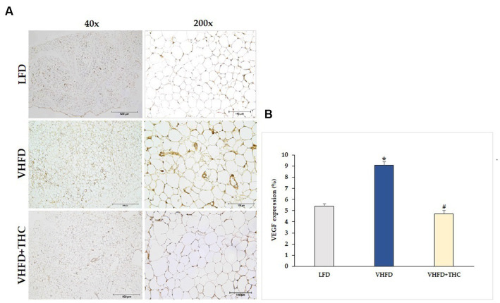 Effect of THC on VEGF expression: (A) representative VEGF expression; left column, magnification 40x; scale bar = 500 μm; right column, magnification 200x; scale bar = 100 μm; (B) %VEGF expression. Data are presented as mean ± SEM. *p < 0.001 vs. LFD group; #p < 0.001 vs. VHFD group.
