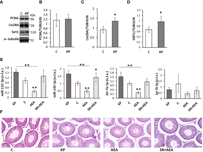 Testicular markers of proliferation, damage, and puberty onset. Representative Western blots (n = 6) for PCNA, Lin28a, and Sirt1 (A) and normalization of PCNA (B) Lin28A (C), and Sirt1 signals (D) carried out against α-tubulin. qPCR (n = 4) for hsa-miR145-5p, has-miR-132-3p, has-let7a-5p, and has-let7b-5p (E). Representative images of testicular morphology by H&E staining, ×10 magnification (n = 4) (F). Data are expressed as protein OD/tubulin OD ± standard deviation in Western blot and as normalized fold expression (n.f.e.) ± standard deviation against the housekeeping gene U6 in qPCR (reference sample arbitrarily assigned 1 to the control group). C, control group (placebo-injected animals); KP, animals injected with Kp10; AEA, animals injected with AEA; SR + AEA, animals first received SR141716A and 30 min later received AEA treatment. *p< 0.05; **p< 0.01.