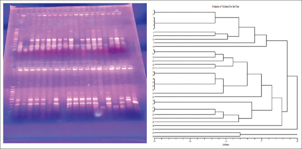 Enterobacterial Repetitive Intergenic Consensus‑polymerase chain reaction and dandograph showing the changes over the obese gut flora before and after Virechana