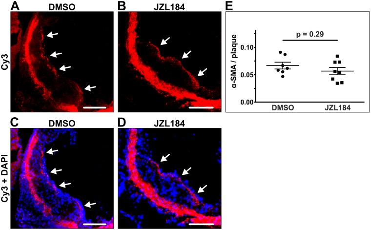 Quantification of smooth muscle cells within atherosclerotic plaques.Smooth muscle cells were stained in the aortic sinus using an immunofluorescent antibody targeting alpha smooth muscle actin. Significant amounts of smooth muscle cells were detected in 7 DMSO-treated animals and in 8 JZL184-treated animals (A, B; white arrows). The proportion of smooth muscle cells to the plaque area was unaffected by JZL184 (C). Data are presented as mean ± standard error of the mean; n = 7–8; p-value as indicated, assessed by student’s t-test. Scale bar, 200 μm. α-SMA, alpha smooth muscle actin; Cy3, cyanine 3; DAPI, 4',6-diamidino-2-phenylindole; DMSO, dimethyl sulfoxide; JZL184, inhibitor of monoacylglycerol lipase.