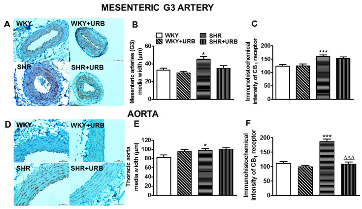 Representative micrographs of the vascular remodeling and immunohistochemical staining of CB1 receptors in cross-sections in the mesenteric G3 arteries (A) and aortic wall (D) from normotensive rats—control (WKY) and URB597-treated (SHR + URB). H + E staining. The bar graph illustrates the measured mesenteric G3 arteries (B,C) and aortic (E,F) medial widths and the intensity of the immunohistochemical reactions for the CB1 receptors, respectively. URB597 at 1 mg/kg or its vehicle was injected intraperitoneally every 12 h for 14 days. Mean ± SEM of n = 5 tissues for each bar; * p < 0.05 and ***,∆∆∆ p < 0.001 compared to the respective control groups (* WKY or ∆ SHR); bar = 50 μm.