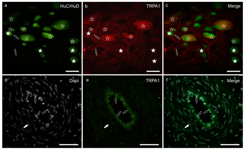 TRPA1 immunoreactivity in the myenteric plexus and blood vessels of the tunica muscularis of the pig ileum: (a) HuC/HuD immunoreactive neurons, (b) TRPA1 immunoreactivity, (c) merge image. The open stars indicate HuC/HuD immunoreactive neurons co-expressing moderate-to-bright TRPA1 immunoreactivity. The white stars indicate HuC/HuD immunoreactive neurons, which were TRPA1 negative. The arrows indicate a TRPA1 immunoreactive neuronal process. (d) Dapi stained nuclei of endothelial cells and vascular smooth muscle cells, (e) TRPA1 immunoreactivity, (f) merge image. The open arrows indicate the Dapi stained nuclei of endothelial cells expressing bright TRPA1 immunoreactivity. The white arrow indicates the elongated Dapi stained nucleus of one smooth muscle cell of the arterial tunica media. Scale bar: 50 µm.