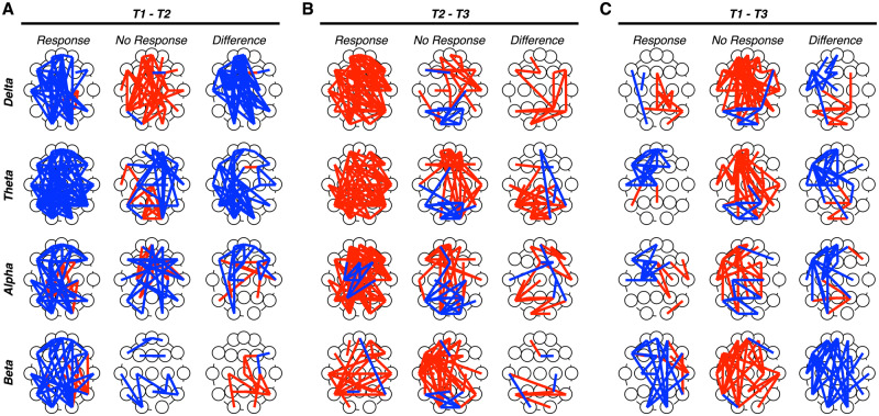Evaluating differences in CBD-related changes in phase coherence between responders and non-responders. Topographic maps of electrode pairs showing an increase (red lines) or decrease (blue line) in phase coherence for each frequency band between T1 and T2 (A), T2 and T3 (B) and T1 and T3 (C) measurements. Patients were separated into responder (left) and non-responder (middle) groups; topographic maps of between-group differences were constructed (right). (A) Between T1 and T2, relatively greater reductions in phase coherence were observed across all frequency bands in the responder relative non-responder group. (B) Between T2 and T3, relative greater increases in phase coherence observed across all frequency bands in both groups. (C) Between T1 and T3, relative greater increases in phase coherence were observed in the non-responder group, whereas the responder group showed greater reductions in phase coherence.