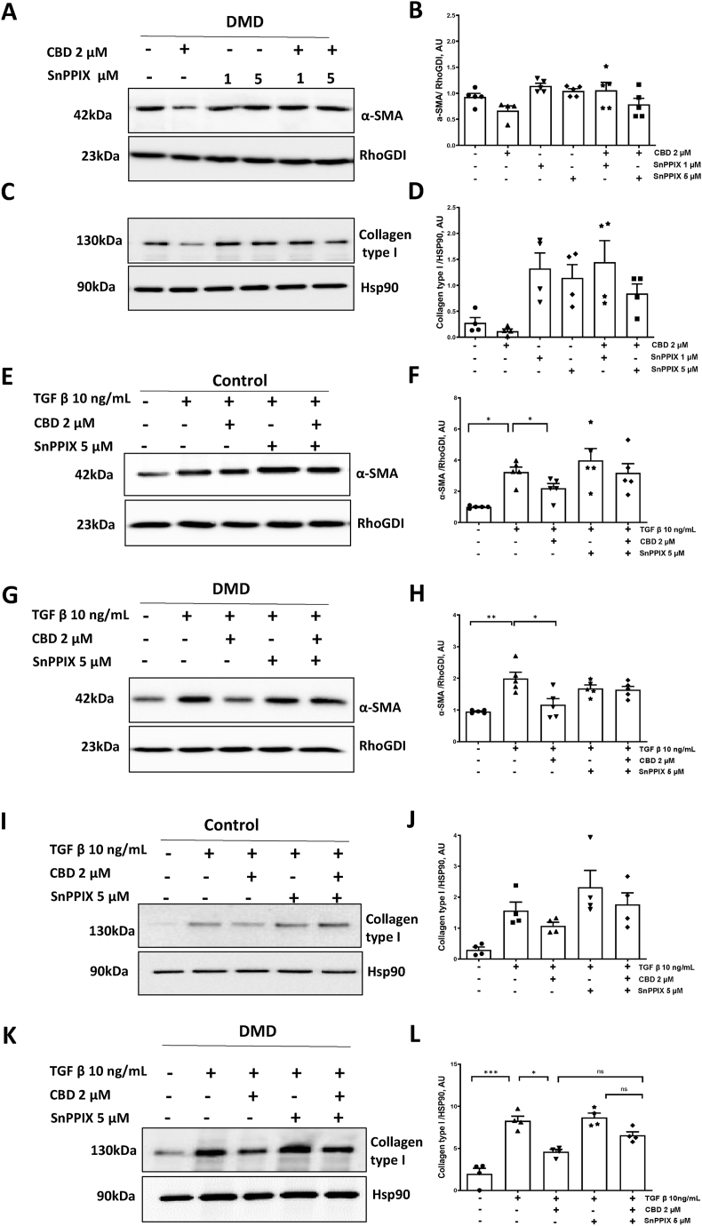 Anti-fibrotic effects of CBD require HO-1 activity.(A–B) Representative western blots and quantification of α-SMA, and (C–D) collagen type I in hiPSC-cFib from DMD patients treated with CBD (2 μM) in the presence or absence of the HO-1 inhibitor SnPPIX (1 or 5 μM) for 24 h. Data are presented as mean ± SEM from three healthy donors and three DMD patients with technical replicates obtained from independent hiPSC-cFib differentiation batches. Statistical differences between treatments in DMD group were evaluated using a non-parametric one-way ANOVA.(E–H) Representative western blots and quantification of α-SMA in hiPSC-cFib from healthy controls (E–F) and DMD patients (G–H) treated with CBD (2 μM, 24 h) in the presence of TGF-β stimulation (10 ng/mL, 24 h) and SnPPIX (5 μM, 24 h). Data are presented as mean ± SEM from n = 3 healthy donors and n = 3 DMD patients, with technical replicates of biological sample obtained from independent hiPSC-cFib differentiation batches. Statistical differences between treatments in control and DMD groups were determined using a non-parametric one-way ANOVA. *P < 0.05,**P < 0.01.(I–L) Representative western blots and quantification of collagen type I in hiPSC-cFib from healthy controls (I–J) and DMD patients (K–L) under the same treatment conditions. Data are presented as mean ± SEM from n = 3 healthy donors and n = 3 DMD patients, with technical replicates of biological sample obtained from independent hiPSC-cFib differentiation batches. Statistical differences between treatments in control and DMD groups were determined using a non-parametric one-way ANOVA. *P < 0.05,***P < 0.001.