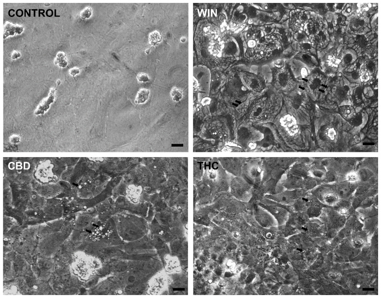 Cannabinoid agonists induce cytoplasmic vacuolization in retinal glial cells in culture. Glia-enriched cultures at E8C13 were treated with 1 µM WIN, 10 µM CBD, or 10 µM THC for 24 h, and then were fixed and imaged under phase contrast illumination. Note the big cytoplasmic vacuoles in WIN-treated cultures and smaller vacuoles in CBD- or THC-treated cultures (arrows). Bar = 20 µm.
