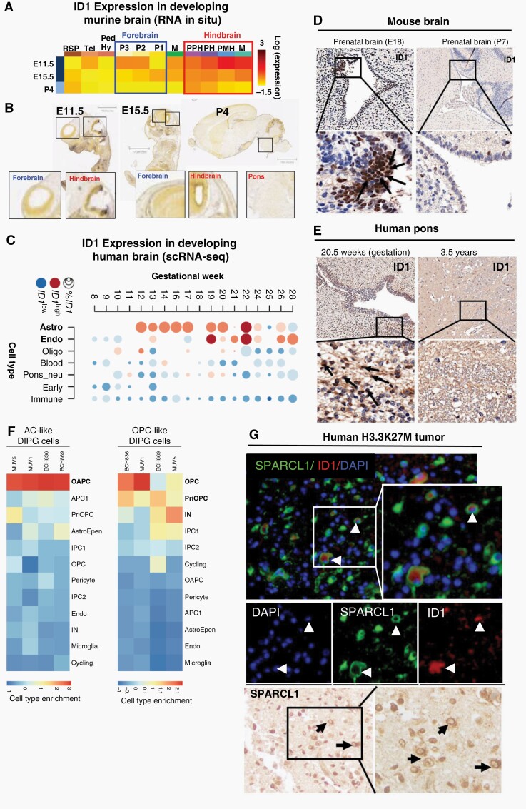 ID1 expression is elevated in developing astrocyte cells in prenatal human and murine hindbrain. (A) Heat map showing relative ID1 expression by in situ hybridization (ISH) in murine brain across development. Available from: http://developingmouse.brain-map.org/. (B) ISH of sagittal developing murine brain sections showing higher ID1 RNA in embryonic hindbrain than forebrain, and minimal ID1 RNA in all postnatal brain [Allen Developing Mouse Brain Atlas. Available from: http://developingmouse.brain-map.org/]. (C) Heatmap of ID1 expression across varying cell types during normal human pontine development [data from Fan et al.24]. Circle size indicates percentage of cells that express ID1 and color indicates expression level in ID1+ cells (red = high expression; blue = low expression). (D) ID1 IHC staining of normal human pontine tissue across development. (E) ID1 IHC of normal murine pontine tissue across development. Magnification = 10× (top row); 40× (bottom row). (F) Overlap of genes expressed by cell types in the developing human pons [Fu et al.] in DIPG tumor cell subsets. (Red = cell type marker genes enriched in DIPG cells; blue = cell type marker genes not enriched in DIPG cells). (G) Immunostaining of SPARCL1 (green) and ID1 (red) in human DIPG tissue showing colocalization of ID1 and SPARCL1 in a subset of cells (white arrow). Scale bar, 20 μm. Tumor nuclei stained with DAPI (blue). IHC staining of SPARCL1in human DIPG tissue (black arrow) (representative of n = 3 human DIPG tumors).