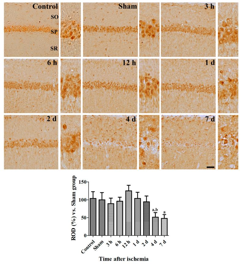Spatial and temporal changes of CRIP1a immunoreactivity in the gerbils at various time points after ischemia. Relative optical densities in each region are described as a percentage of the value of the sham group, and a one-way ANOVA test was used to analyze the data followed by Bonferroni’s post-hoc test (n = 5 per group; a p < 0.05, significantly different from the Sham group; b p < 0.05, significantly different from the pre-adjacent group). SO, stratum oriens; SP, stratum pyramidale; SR, stratum radiatum.