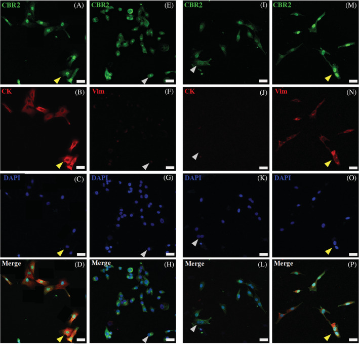 CBR2 (CBR2‐green) confocal microscopic results, showing images of equine primary skin‐derived cultures of keratinocytes (A‐H) and fibroblasts (I‐P). CBR2 immunoreactivity in keratinocytes (A and E) and fibroblasts (I and M). For keratinocyte and fibroblast immunophenotyping, co‐labeling with specific epithelial pan‐cytokeratin (CK‐red) (B) and fibroblast vimentin (Vim‐red) (N) markers was performed (yellow arrows indicate double positive cells). In turn, inverse staining of Vim‐red on keratinocytes (F) and CK‐red on fibroblast (J) was additionally performed to distinguish both primary cell types (gray arrows indicate single positive cells). The DAPI (blue) was used for cell nucleus counterstaining; images were taken under 40x magnification; scale bars = 20 μm