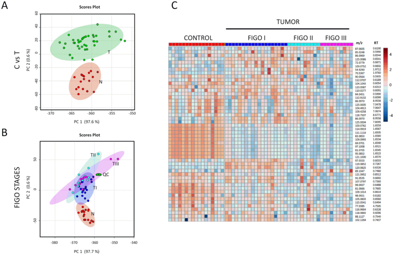 Multivariate analysis showing metabolic profiles in EC. Principal Component Analysis (PCA) plots showing separation between EC tissue samples (T, in green) and control tissue samples (N, in red) (Panel A) and separation between different EC FIGO stages (stage 1: TI, stage 2: TII, stage 3: TIII) (Panel B) for the positive MS ionization mode. X-axis shows interclass separation and Y-axis illustrates the intra-class variability. Panel C. Heat map of ion rankings, corresponding to their relative concentrations (intensity) for positive MS ionization mode, in the same cohort of subjects. Each row represents a unique feature with a specific m/z and RT while each column represents a unique subject. (m/z: mass to charge ratio; RT: retention time).